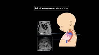 Special embryology  foetal circulation [upl. by Gereld]