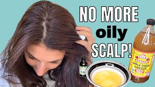 LIFE CHANGING DIY Hair mask for OILY HAIR  NO MORE OILY SCALP [upl. by Nylekoorb]