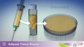 What do Mesenchymal Stem Cells Look Like In Culture [upl. by Artenra362]