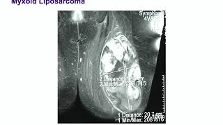 Types of Tissue Part 4 Nervous Tissue [upl. by Ylrebmi]