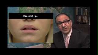 Lip lift Alternative to Lip Augmentation amp How to Avoid Duck Lips [upl. by Lodmilla823]