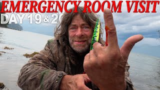 Greg Days 19 amp 20 BAD Hook Injury Medical Emergency  30 Day Survival Challenge Vancouver Island [upl. by Qidas]