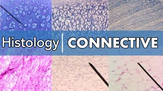 Histology  Connective Tissue [upl. by Martinsen]